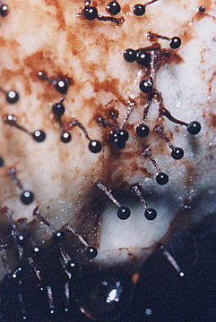 Moisissures en têtes d'épingle, taille 1 cm.